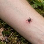 Tick bite on arm in the woods over foliage