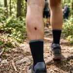A tick attached to a leg of a hiker in the woods